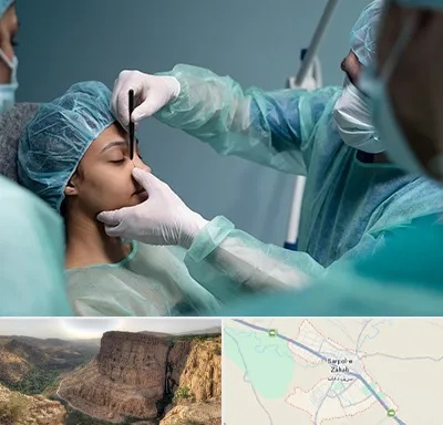 عمل بینی ارزان در سرپل ذهاب