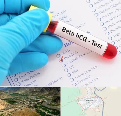 آزمایشگاه بارداری در اسدآباد