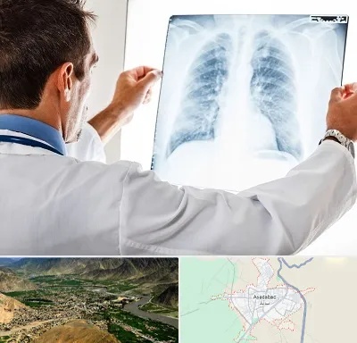 دکتر متخصص ریه در اسدآباد