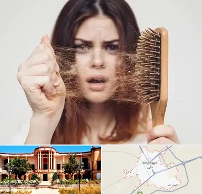 دکتر ریزش مو در خمین