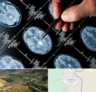 دکتر تشنج در اسدآباد
