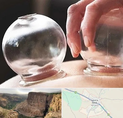 مرکز حجامت در سرپل ذهاب