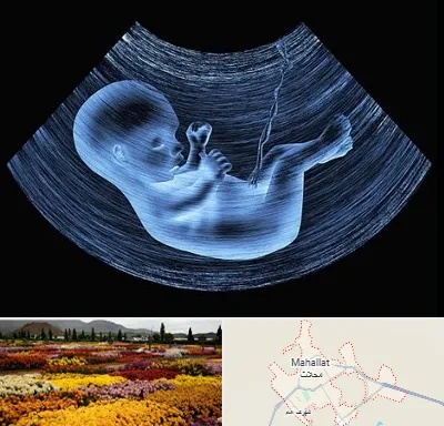 دکتر متخصص غربال گری در محلات