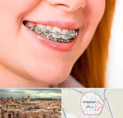ارتودنسی ارزان در اردکان