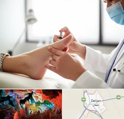 متخصص زخم دیابت در دلیجان