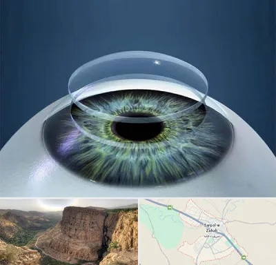 پیوند قرنیه در سرپل ذهاب