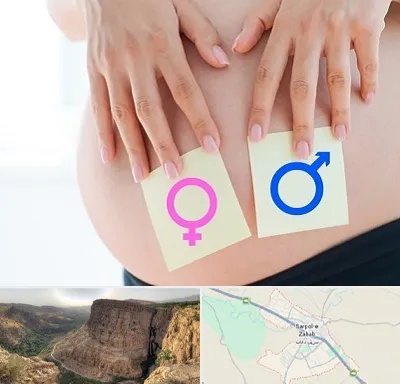 کلینیک تعیین جنسیت در سرپل ذهاب