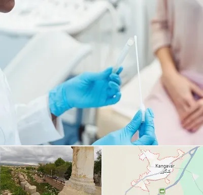 دکتر زگیل تناسلی HPV در کنگاور