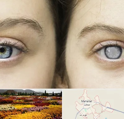متخصص آب سیاه (گلوکوم) در محلات