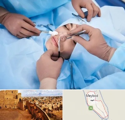 عمل بینی فانتزی در میبد
