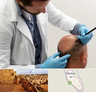 کاشت مو به روش تکثیری در میبد