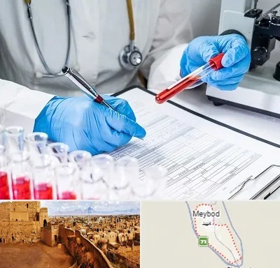 آزمایشگاه اعتیاد در میبد