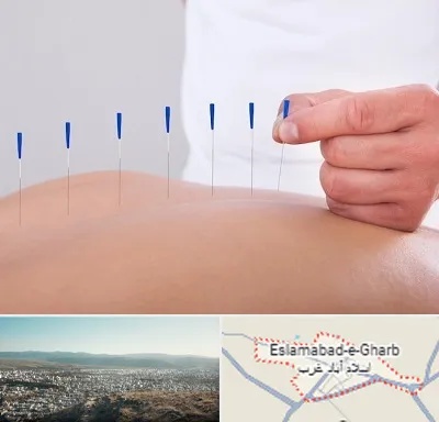 دکتر طب سوزنی در اسلام آباد غرب