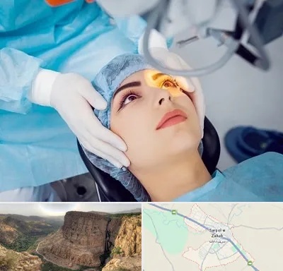 دکتر عمل لیزیک چشم در سرپل ذهاب