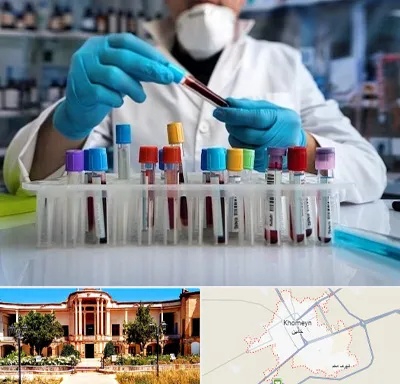 آزمایشگاه خون در خمین