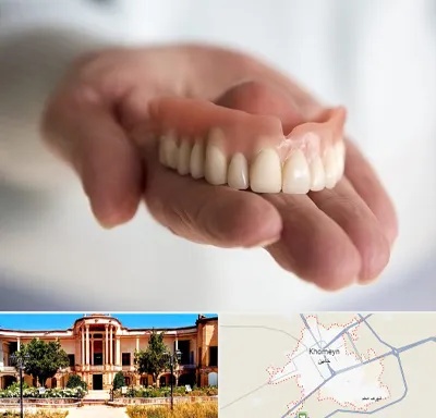 لیفت لثه با لیزر در خمین