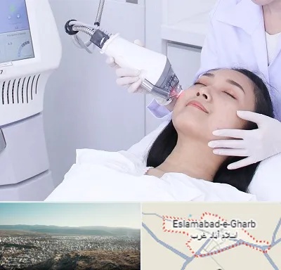 وایتنینگ در اسلام آباد غرب