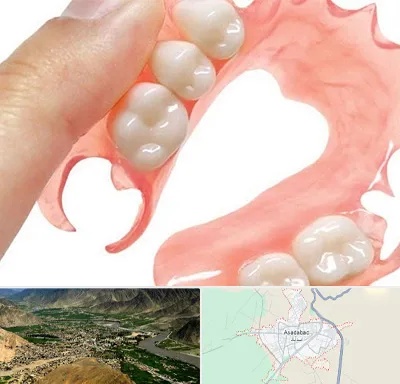 پروتز متحرک دندان در اسدآباد