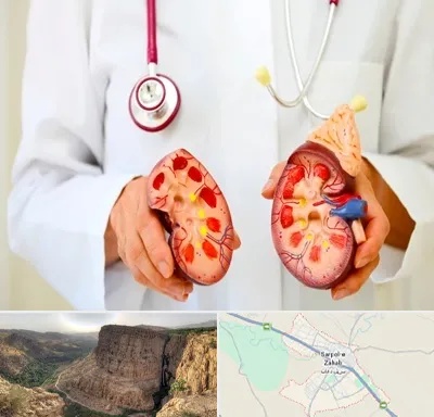دکتر سنگ کلیه در سرپل ذهاب