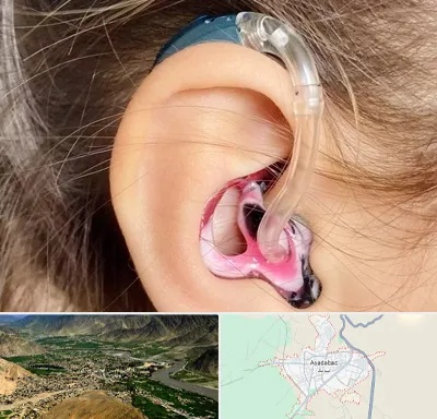 ساخت قالب سمعک در اسدآباد