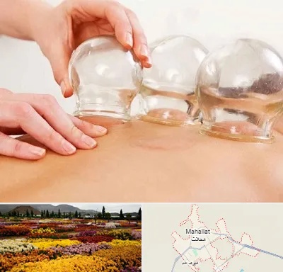 بادکش درمانی در محلات