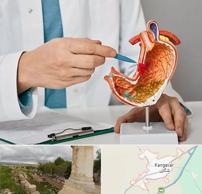 دکتر سرطان معده در کنگاور