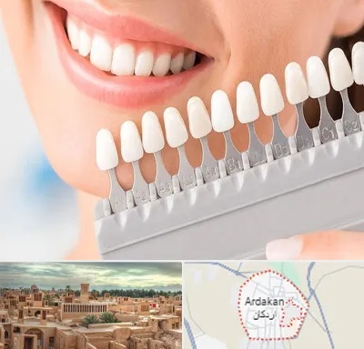 متخصص لمینت دندان در اردکان