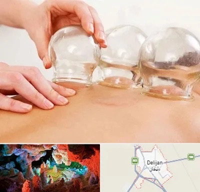 بادکش درمانی در دلیجان