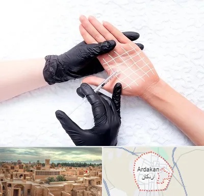 تزریق بوتاکس کف دست در اردکان