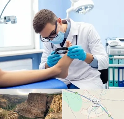 درمان زخم پای دیابتی در سرپل ذهاب