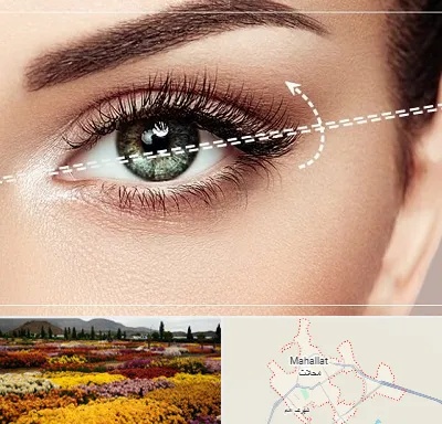 جراحی چشم گربه ای در محلات