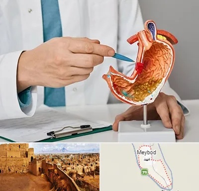 دکتر سرطان معده در میبد