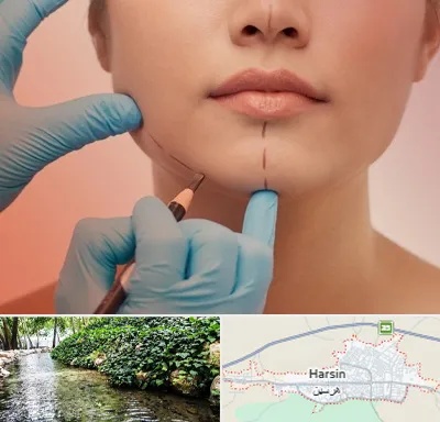 دکتر زیبایی خانم در هرسین