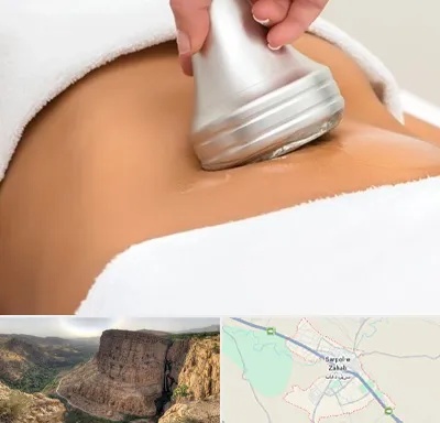 دستگاه لاغری در سرپل ذهاب