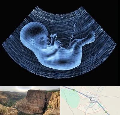 دکتر متخصص غربال گری در سرپل ذهاب