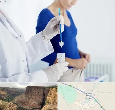 آزمایشگاه پاپ اسمیر در سرپل ذهاب