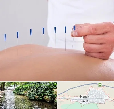 دکتر طب سوزنی در هرسین