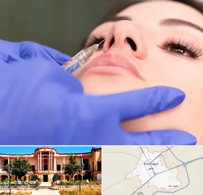 هیالاز در خمین