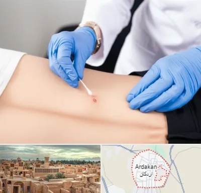 متخصص زخم بستر در اردکان