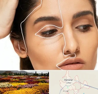 عمل بینی اقساطی در محلات