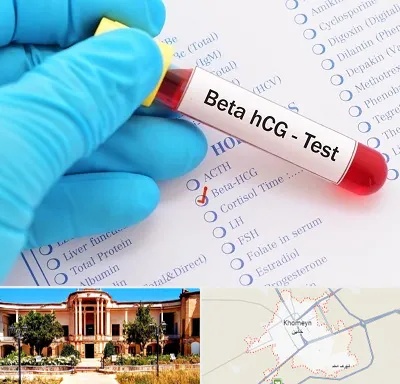 آزمایشگاه بارداری در خمین
