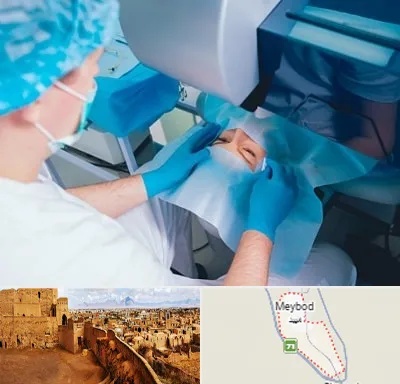 دکتر عمل لازک چشم در میبد