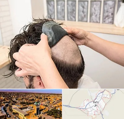 پروتز مو در بافق