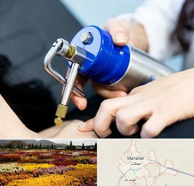 کرایوتراپی در محلات