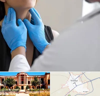 دکتر سرطان گلو در خمین