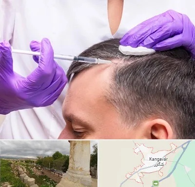 دکتر فوق تخصص پوست و مو در کنگاور