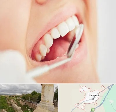 اصلاح طرح لبخند در کنگاور