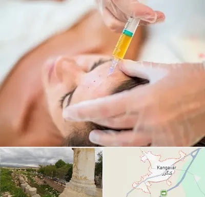 پی آر پی در کنگاور