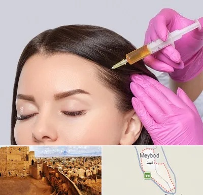 تزریق هیر فیلر در میبد