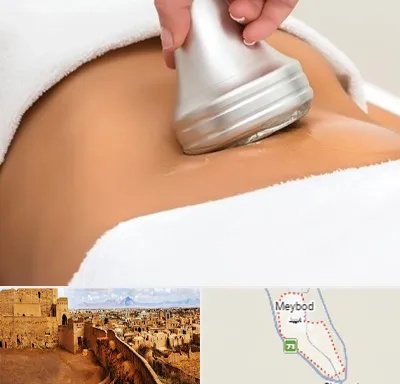 دستگاه لاغری در میبد